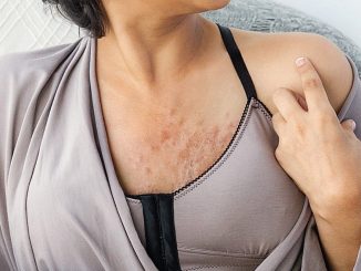 Is Wearing A Bra/Brassiere a Cause of Breast Cancer?