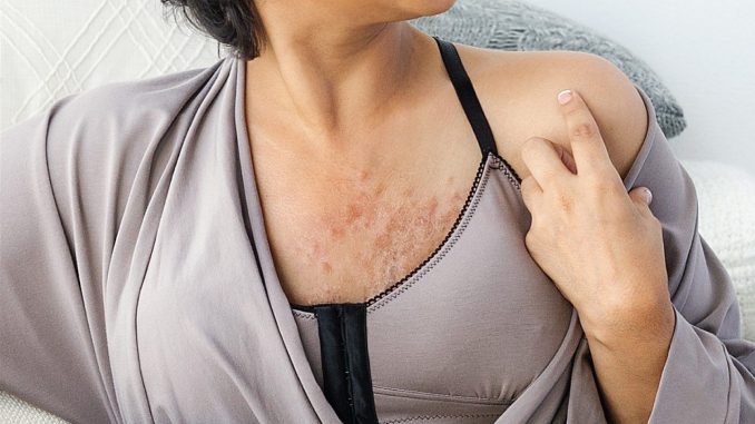 can wearing a bra in bed cause cancer
