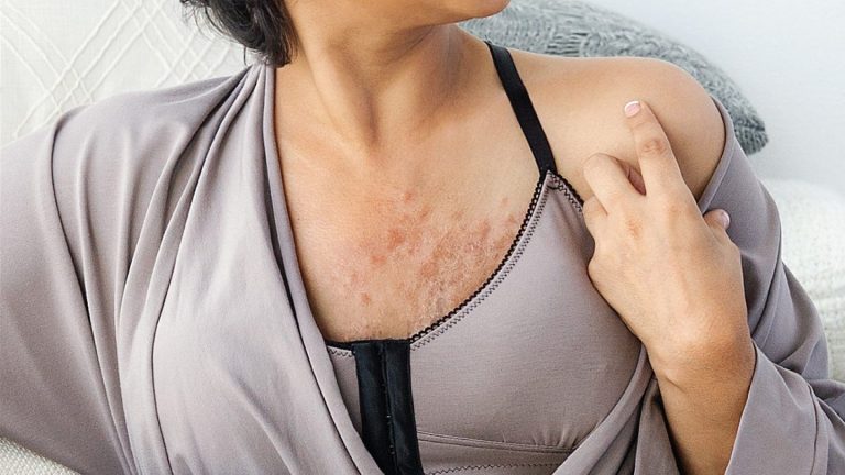 Is Wearing A Bra/Brassiere a Cause of Breast Cancer?